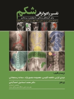 تفسیر رادیوگرافی شکم